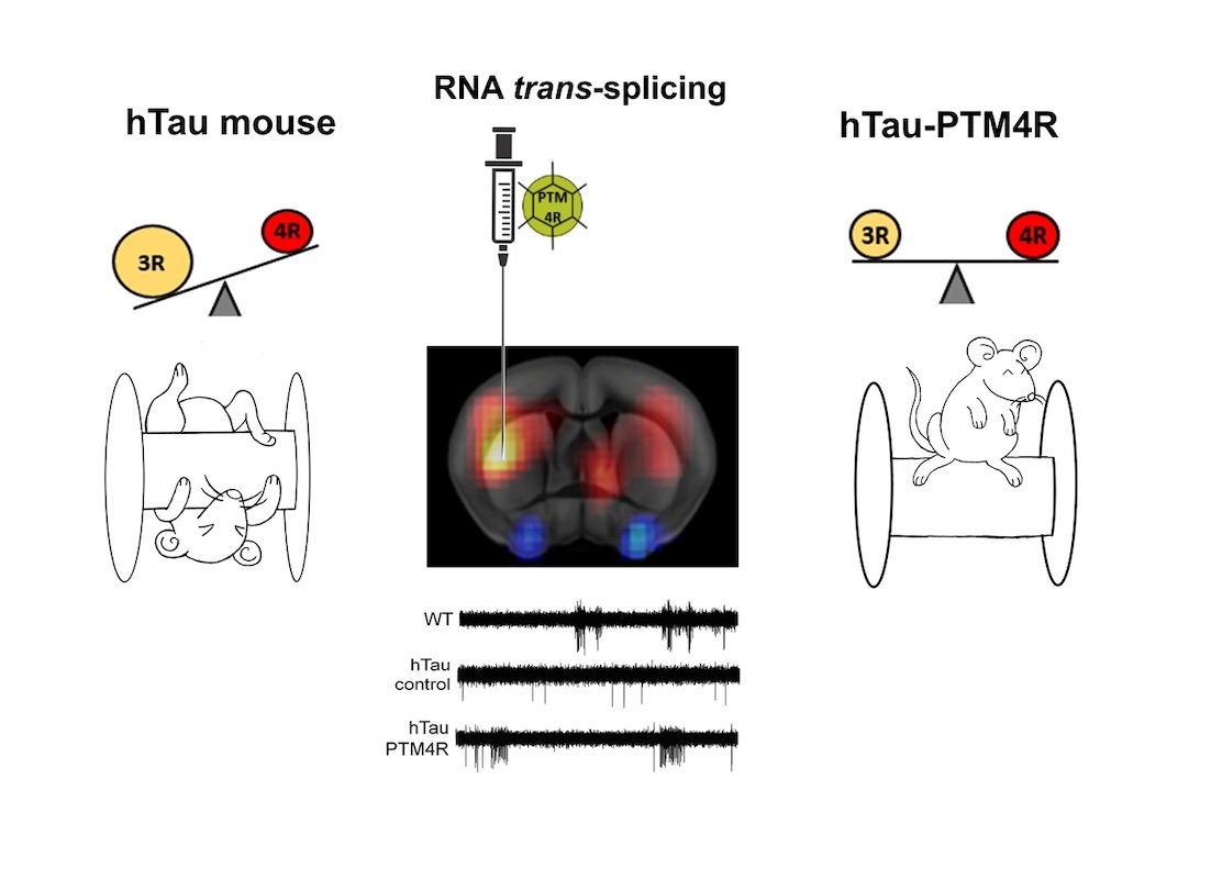 Brain1878's tweet photo. Damianich et al. show that tau mis-splicing correlates with motor impairments and striatal dysfunction in a model of tauopathy. https://t.co/zbwyQaorQt https://t.co/7mNvuJSikZ