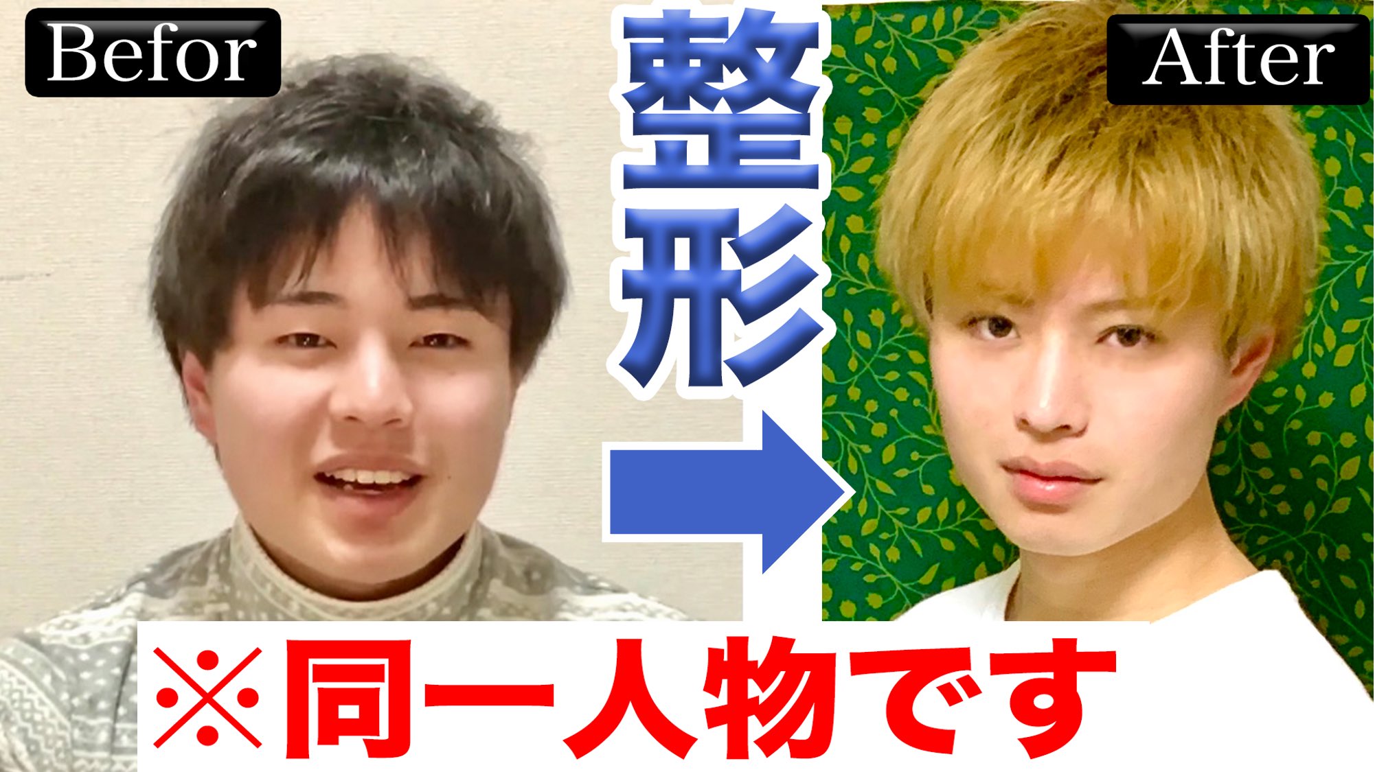 男の整形 Twitter Search Twitter