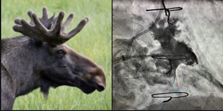 Orejuela “cabeza de alce”. Cada orejuela una morfología, cuestión de imaginación. Lo importante; se ha cerrado con éxito. #Amulet 22 mm. <a href="/mgonzale2/">Manuel G. Correa</a> <a href="/dvillagomez4/">David Villagómez</a> <a href="/SebastianRufian/">Sebastián Rufián</a>