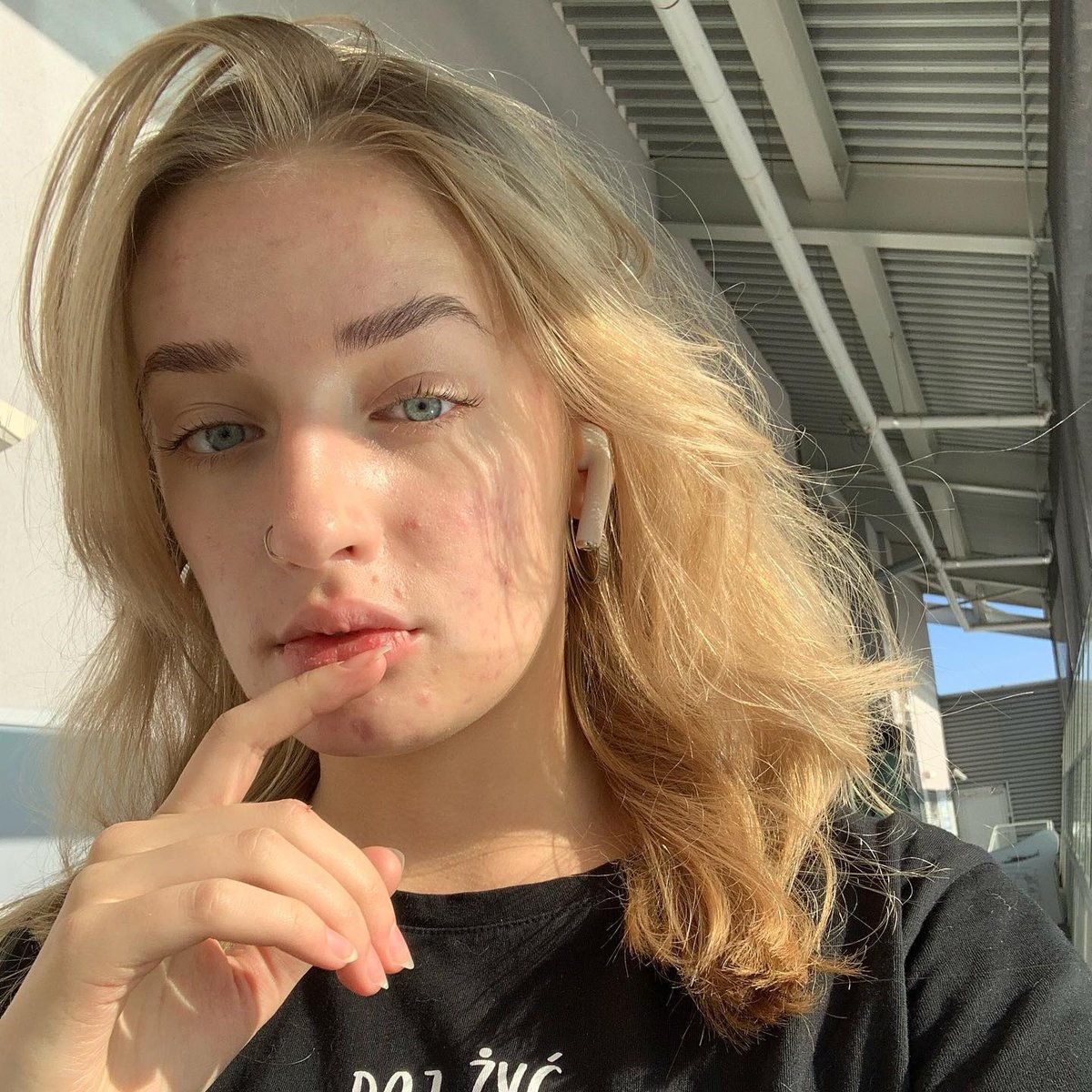 June is Acne Awareness Month! 💚 This month, we'll be raising awareness about the different types of acne &amp; their impacts, along with different types of treatments.