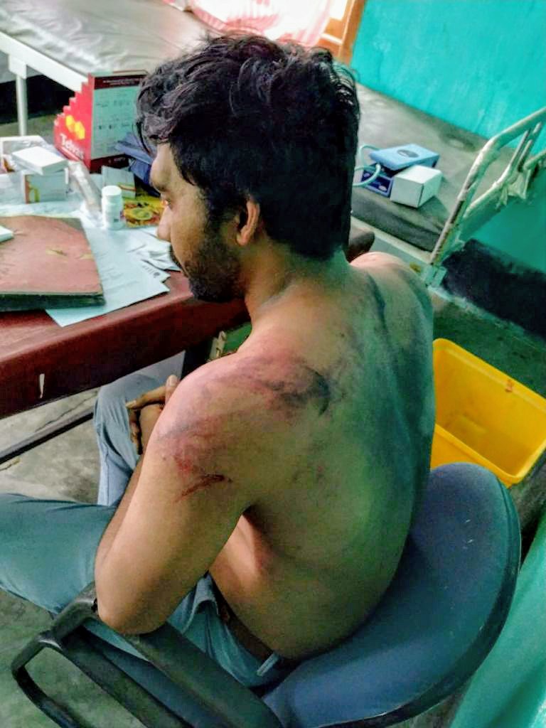 Runjhunsharmas's tweet photo. Doctor Seuj Kumar was brutally attacked at a #COVID Care Center in Hojai, Assam today by a patient's relatives after he died from severe covid pneumonia. https://t.co/mOlsYiaWLe