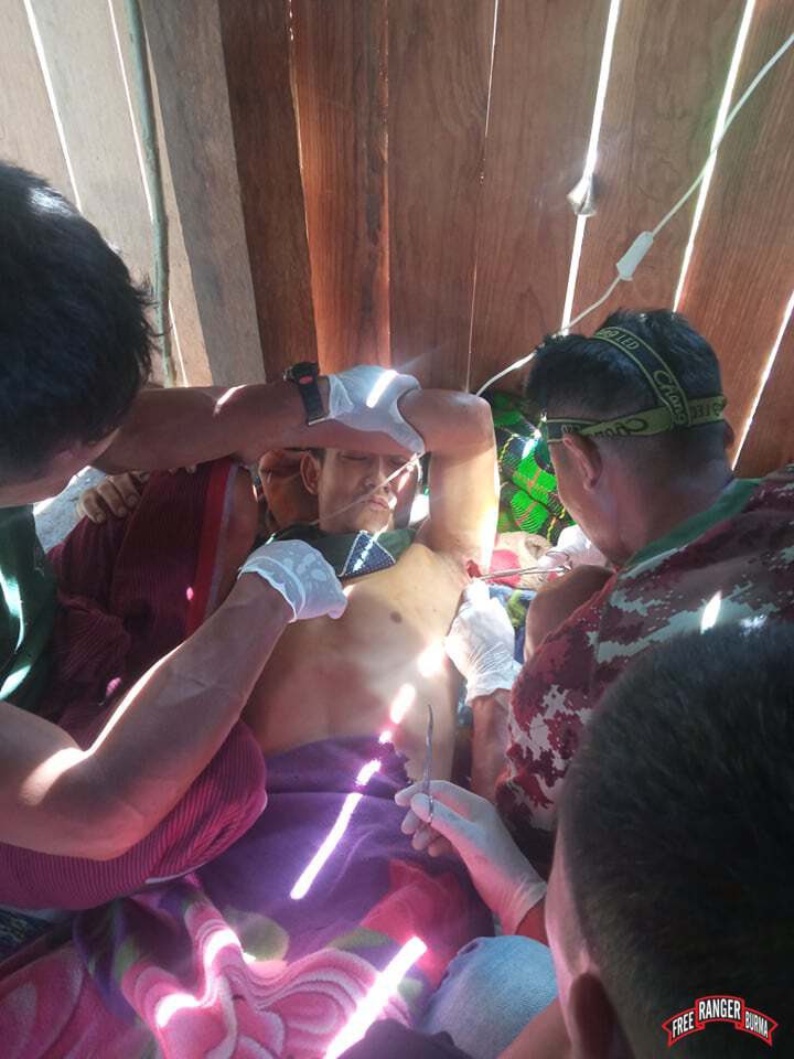 FreeBurmaRangrs's tweet photo. There are over 40,000 people displaced by attacks of the Burma Army with daily mortar and machine-gun attacks; villagers’ farms and homes are hit and villagers continue to be hit. Saw Kit Mae, 32 yrs old, is one of the villagers wounded and he is now being treated at our clinic. https://t.co/oq5hLCgErX