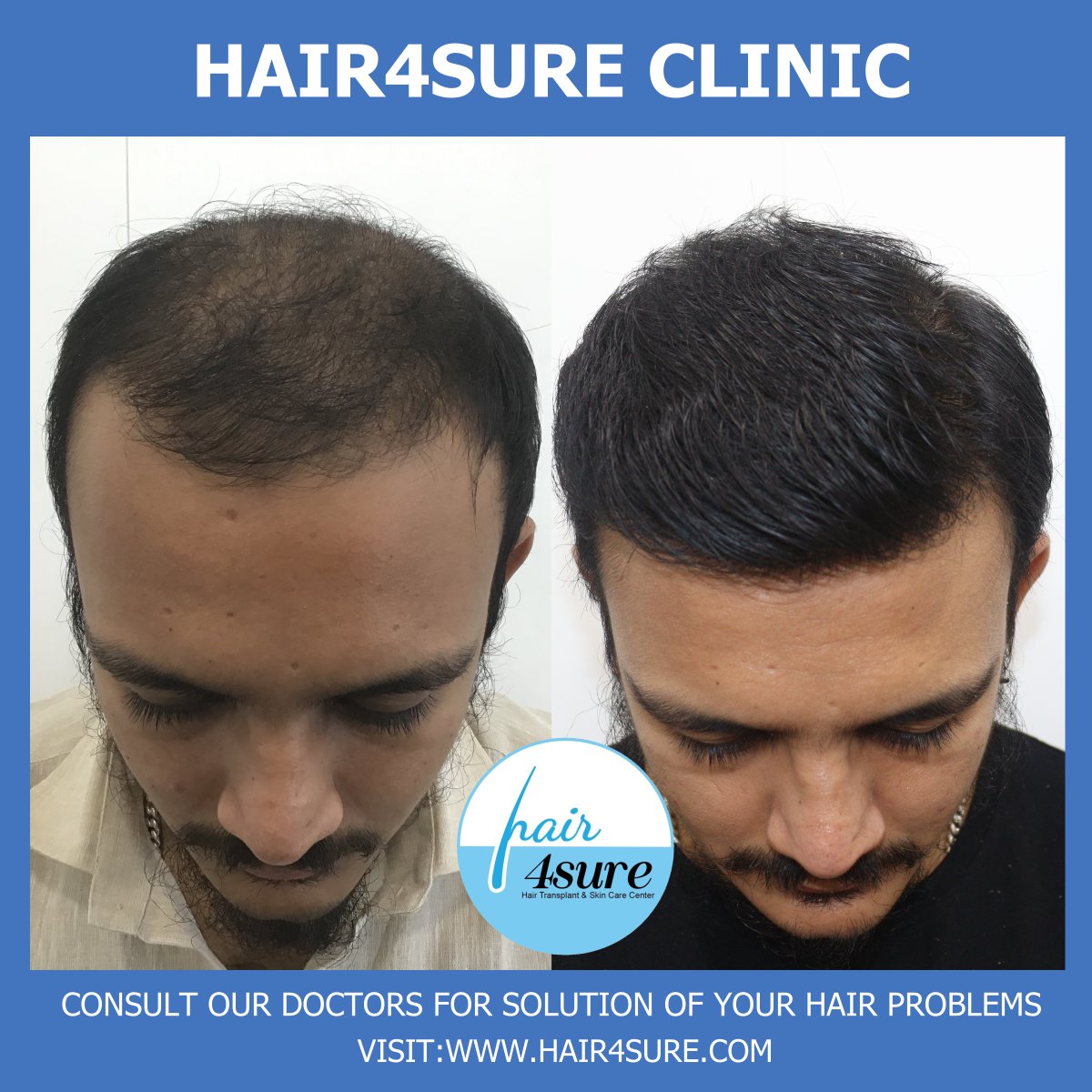 Hair4Sure on Twitter: Hair4Sure on Twitter: