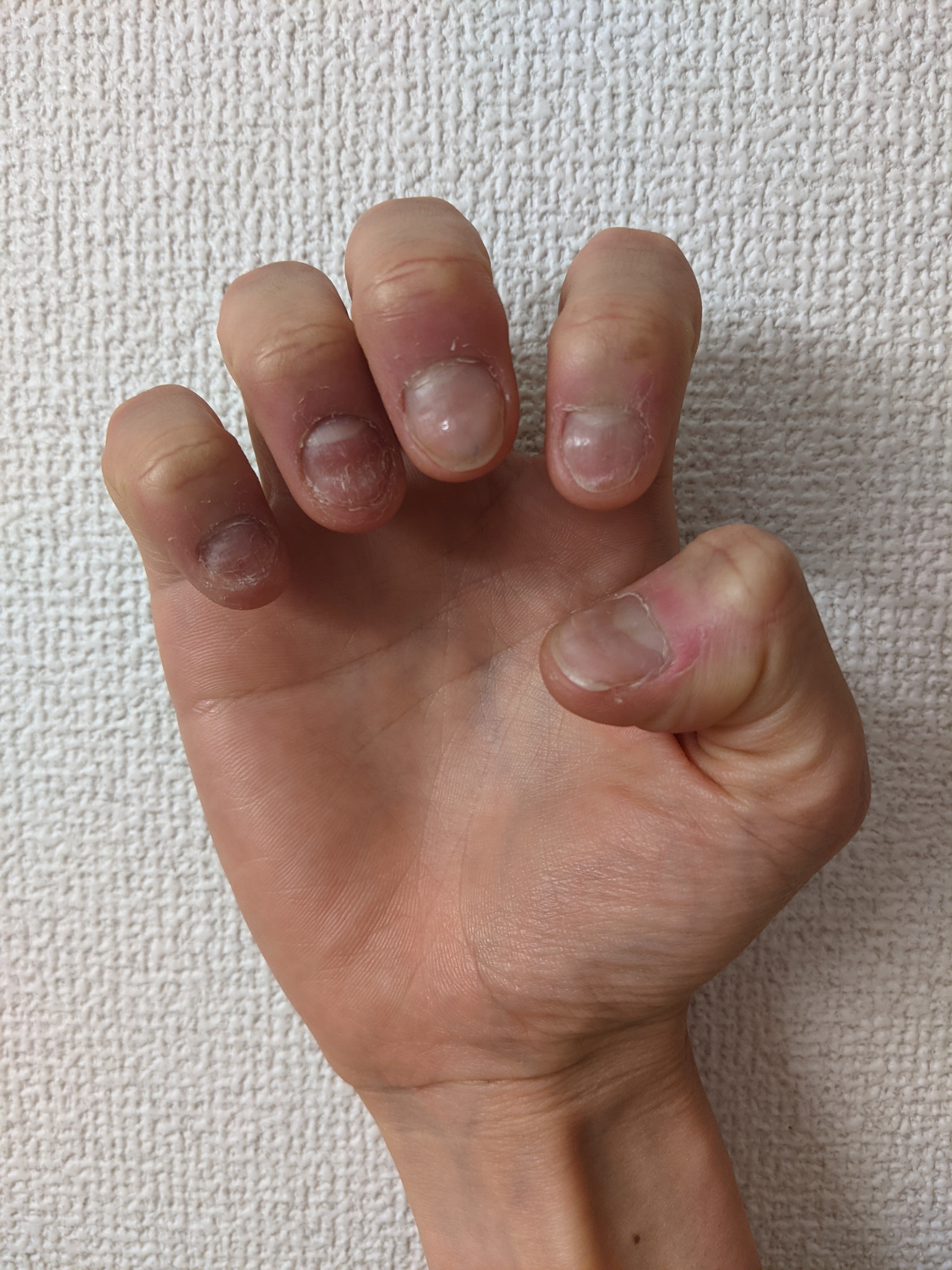 Stopnailbiting Twitter Search Twitter