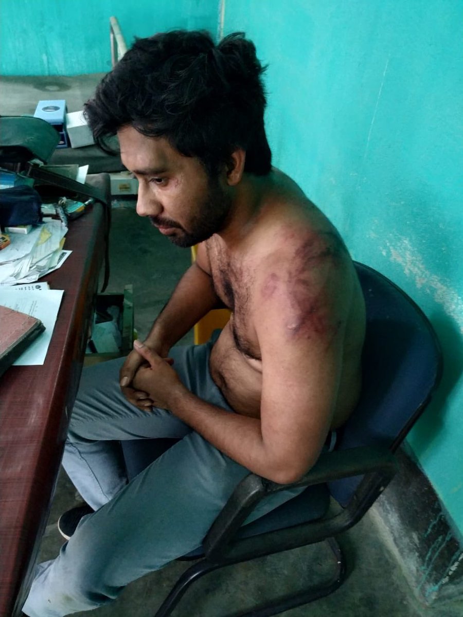 drsfaizanahmad's tweet photo. Mob #dragged Dr Seju MO of Hojai Assam from his house and brutally beat him. He unable to save the patient because of limited facilities at PHC

This happens when people like #Ramdev provoke the general public that Doctors are killing the patients.

#BlackDayProtest https://t.co/tWr5lxfrgl