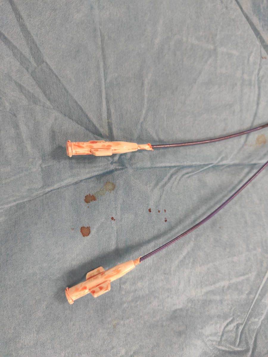 klinki_hh's tweet image. Thanks to a shortly posted #cathlabhack by @KardiologieHH we were able to stay #radialfirst 💪🏻💪🏻💪🏻

@AGAPLESIONgAG #diakonieklinikhamburg

@PCRonline @AGIKinterv @YoungDgk @DGK_org @HolgerNef @kaschenke @MoritzSeiffert @felixmeincke @CardioSchmidt