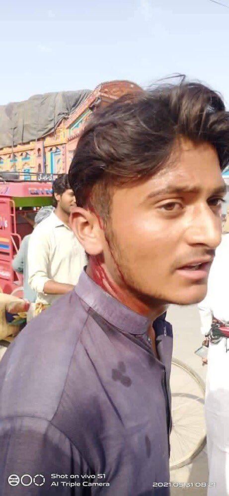 AartMeo's tweet photo. #cancelboardexam2021 #NCOC #ShafqatMahmood

JITNA ZULM KRNA HE KR LO 

HM APNA HAQ LIYAY BGHER NHI JANAY WALAY 🪧➰🪧—-

CANCEL EXAMS OR EXTEND EXAM DATES 🪧➰🪧—-#Shafqatmehmood #CancelAllExams #cancelcbse12thboardexams2021 #TimeDoYaPromotionDo #delay12boardexam https://t.co/43e0f8iaJP