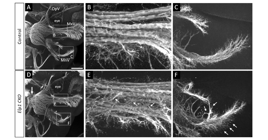 AutonomicAus's tweet photo. Loss of Elp1 disrupts trigeminal ganglion neurodevelopment in a model of Familial Dysautonomia, from @UofMaryland & @montanastate, on @biorxivpreprint
https://t.co/rwFGqKZ9rN
#familialdysautonomia #geneknockout #neurodevelopmental #mousemodel #trigeminal #ganglion #devbio https://t.co/MRoBEyRkHD