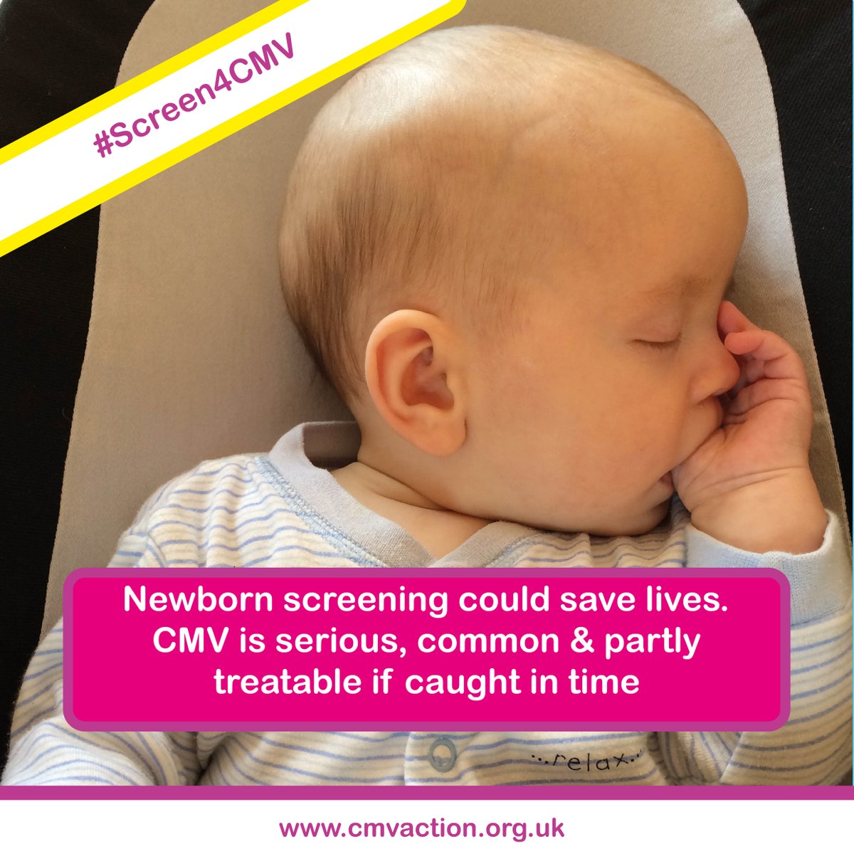 Newborn screening could save lives. CMV is serious, causing conditions such as hearing loss, vision loss, cerebral palsy, seizures
& more. It is partly treatable if caught in time. Please sign our petition for screening & change lives ow.ly/SNDj50FaKyw #screen4CMV #stopCMV