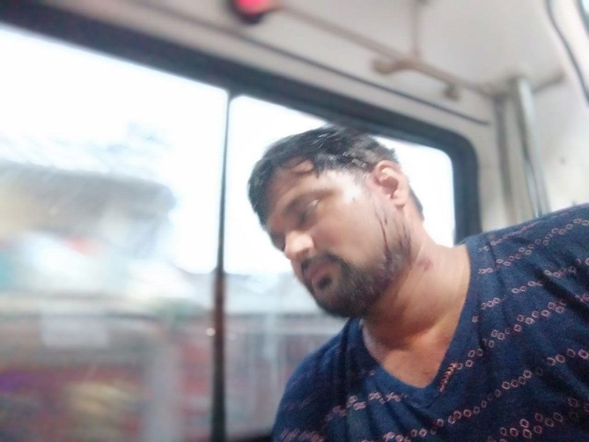 DrGyanBharat's tweet photo. आशीष दुबे निवासी आनंदडीह थाना दुर्गागंज भदोही, के ऊपर पर प्राणघातक हमला हुआ वह भी अपने जमीन पर बाउंड्री करने की वजह से विवाद पड़ोसियों से है जो कानूनी कागजों को मान नहीं रहे ऊपर से दुर्गागंज पुलिस f.i.r. नहीं लिख रही।
@bhadohipolice @IgRangeVaranasi @Uppolice @CMOfficeUP https://t.co/N02hRdzbtQ
