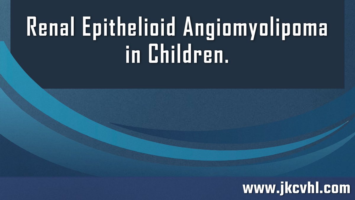 Renal Epithelioid Angiomyolipoma in Children.
Complete article available at 
jkcvhl.com/index.php/jkcv…
#renal #kidneycancer