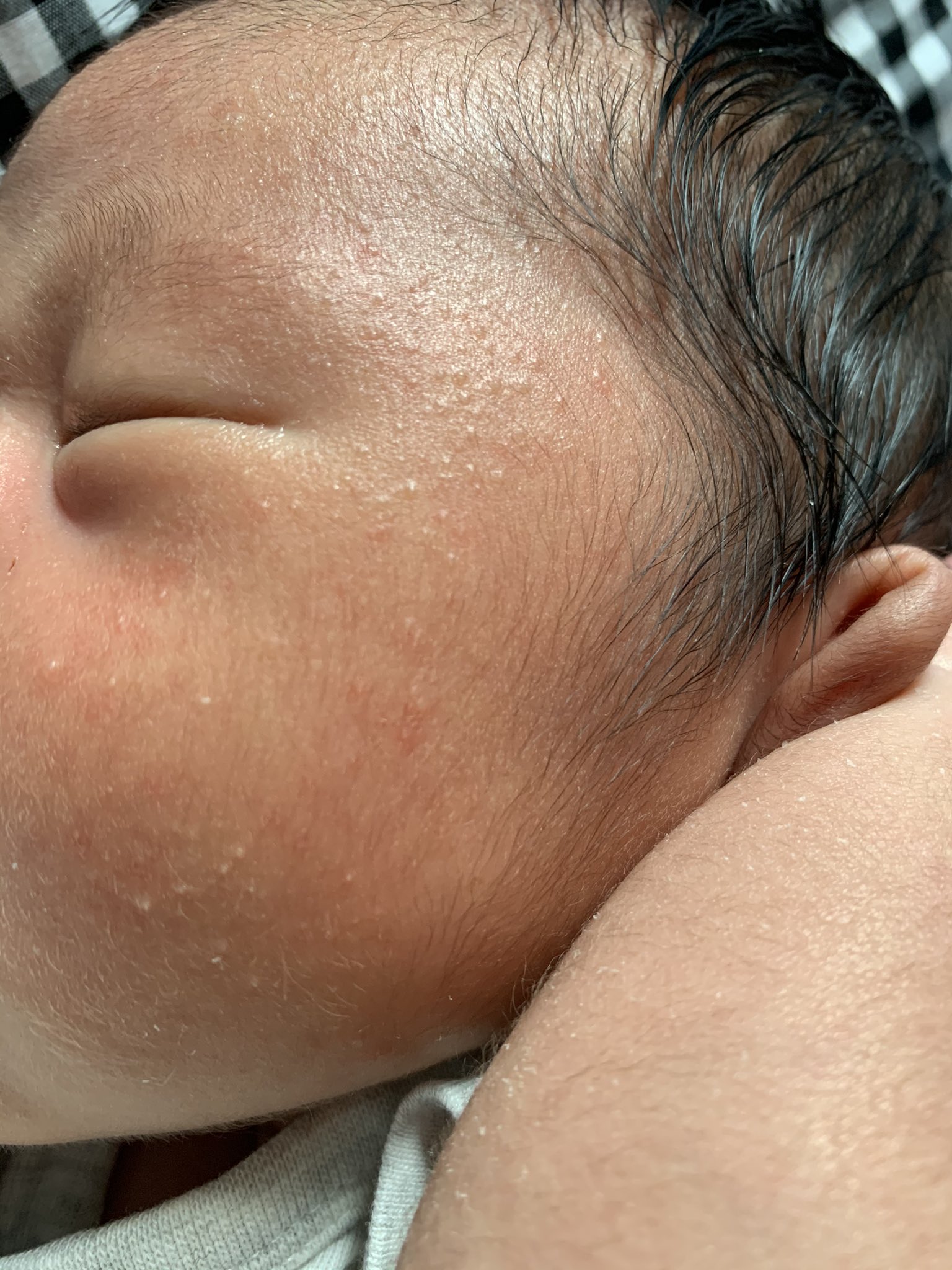 Gsg 倉持由香 新生児ニキビなのかな 白いプツプツができてしまった いまは沐浴で洗った後 カレンデュラオイルで保湿してるんですが 何かいいアイテムありますでしょうか T Co Brqaodple9 Twitter