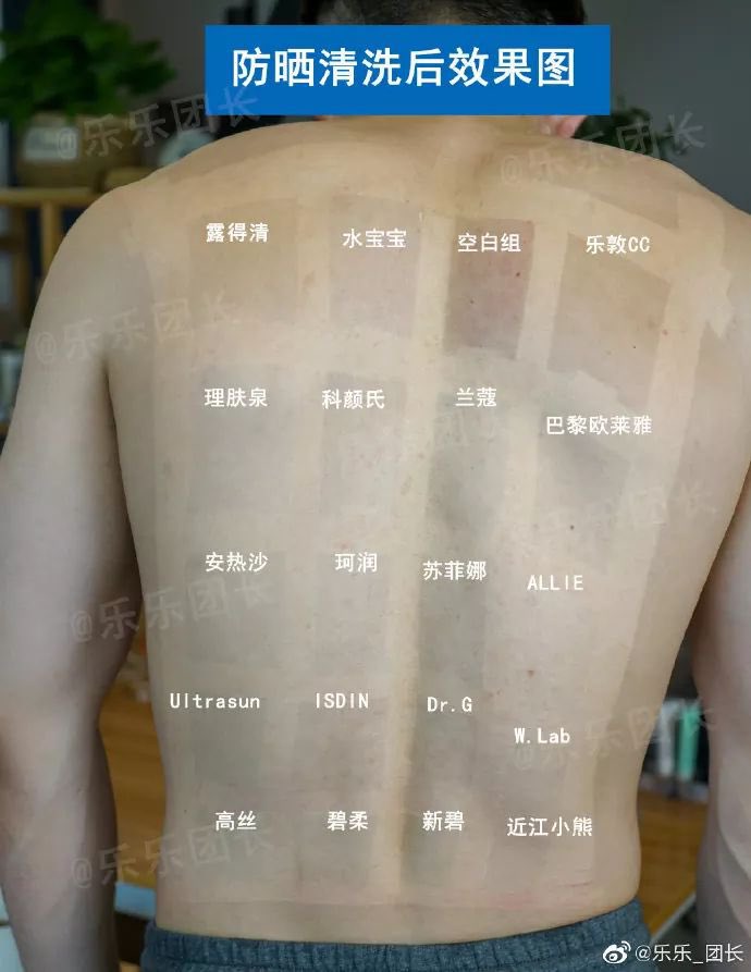 ネットで見つけた日焼け止め実験画像を見てallieを実際に使ってたら全然やけなかった 部活してた時マジでコレとアネッサは優勝だった Togetter ネットで見つけた日焼け止め実験画像を見てallieを実際に使ってたら全然やけなかった 部活してた時マジでコレとアネッサは優勝だった Togetter