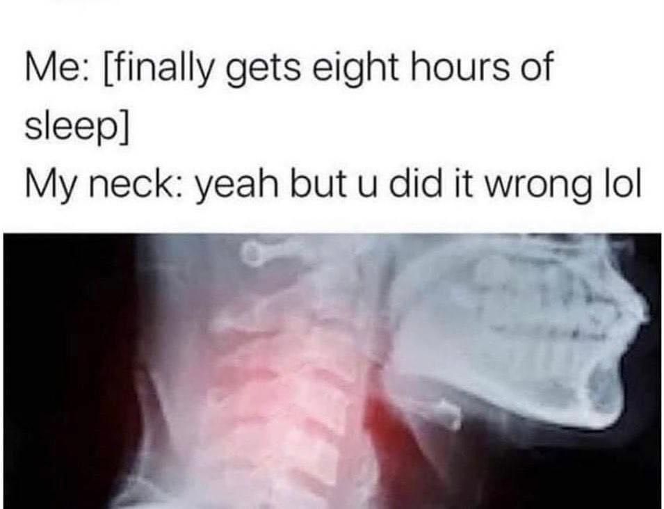 myunclesmemes's tweet photo. Me irl https://t.co/ybfvgRTdXN