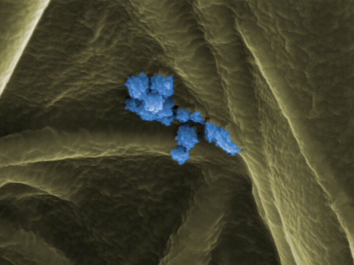 UniversidadMH's tweet photo. Esta es la forma real del #COVID19 🦠🔬 La imagen ha sido obtenida con microscopía electrónica de barrido en un filtro de fibra de vidrio con #coronavirus SARS-CoV2. Se trata de una técnica desarrollada por #investigadoresUMH para detectar aerosoles ➡ https://t.co/HlUY0J5RZ7 https://t.co/Gd2N19AqMF