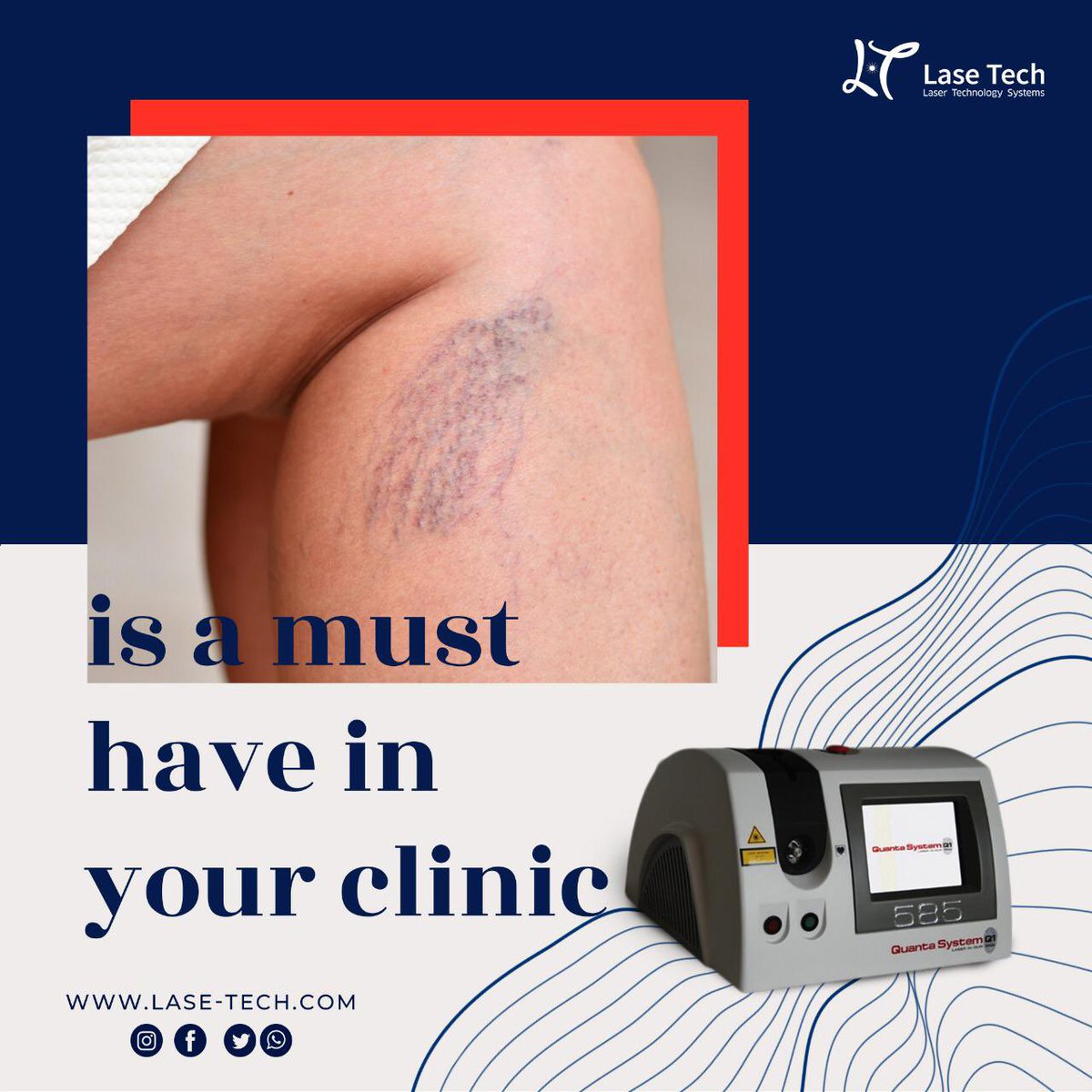 laseTechsystems's tweet image. Why 585 is a must have?

Because using the 585 laser, vascular lesion treatments are improved due to a greater penetration depth and lower epidermal melanin absorption, with a 50% reduction.

Lase-tech.com

#Lasetech #585laser #BeQuanta #YellowLaser #quantasystem