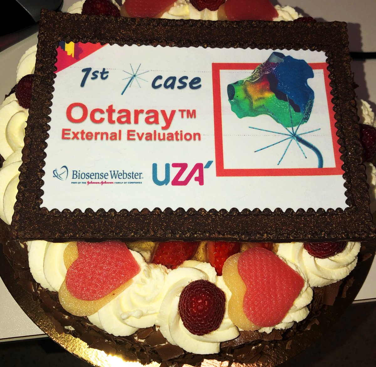 MBergonti's tweet image. 08/06/2021 - First European cases with #Octaray, @BiosenseWebster mapping catheter. Fast mapping, clear signals, very few motion artifacts. #HDmapping, #Epeeps

with @AndreaSarkozy and @HH4EHRA 
Thanks to @Salavtore4, Stefan Henkens, Inge Benoy, Dan Steinberg
At #UZA, Antwerp.