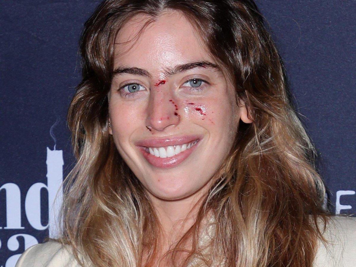 Ewan McGregor’s daughter bitten in the face by dog moments before film premiere