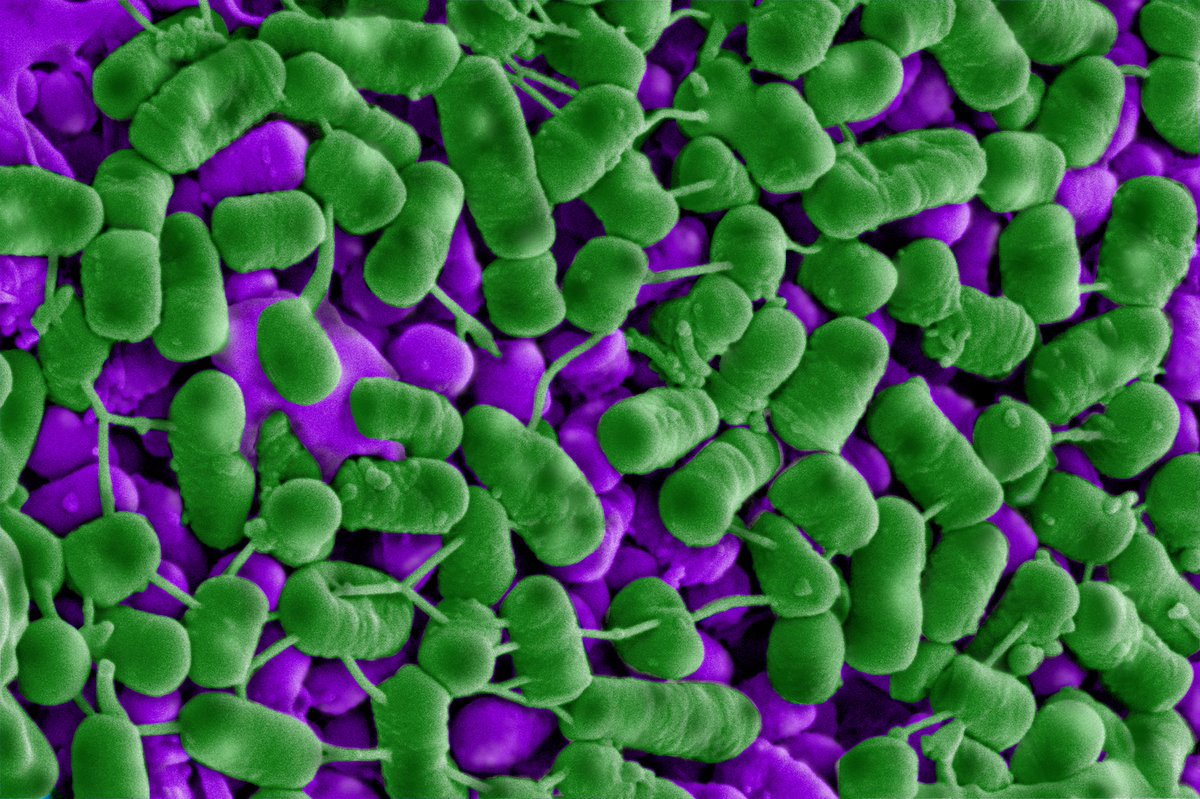 ⏣ Prof. Oliver Jones (@dr_oli_jones) on Twitter photo So exciting to see that a <a href="/ResearchRMIT/">RMIT Research</a> news article with <a href="/ElvinaCao/">Dr Elvina Parlindungan</a> on a new natural food preservative from bacteria has been quoted all over the world - Vietnam, France, Germany, USA, UK etc. Free access to the original paper at authors.elsevier.com/a/1d5lf4r7VbMp… #foodscience #innovation So exciting to see that a <a href="/ResearchRMIT/">RMIT Research</a> news article with <a href="/ElvinaCao/">Dr Elvina Parlindungan</a> on a new natural food preservative from bacteria has been quoted all over the world - Vietnam, France, Germany, USA, UK etc. Free access to the original paper at authors.elsevier.com/a/1d5lf4r7VbMp… #foodscience #innovation