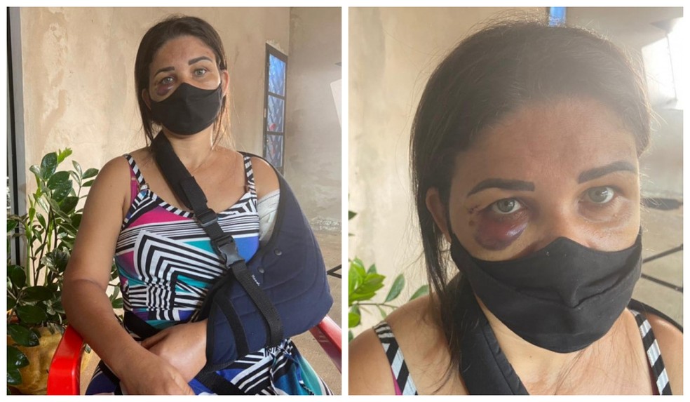 g1's tweet photo. Funcionária de padaria tem braço quebrado por cliente após pedir para homem usar máscara contra a Covid https://t.co/ABrTNnOAbs #G1 https://t.co/SJHdc3NZ2q