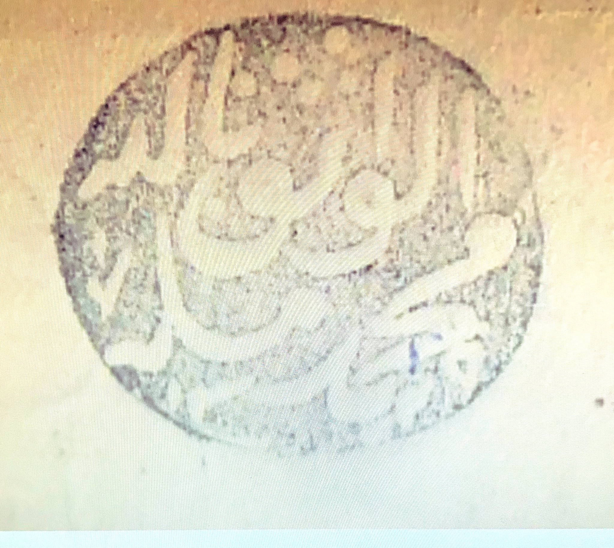 الصورة