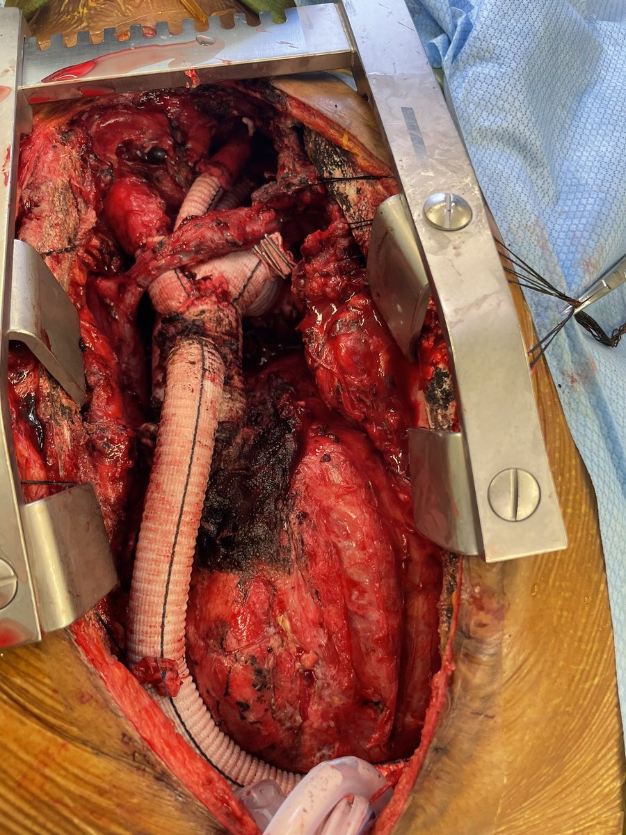 Jacob Niall Schroder tweet media