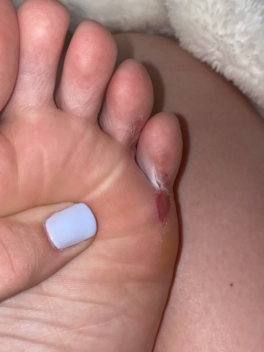 I think the lake won this weekend 🥴    Highly do not recommend falling off the back of a boat.