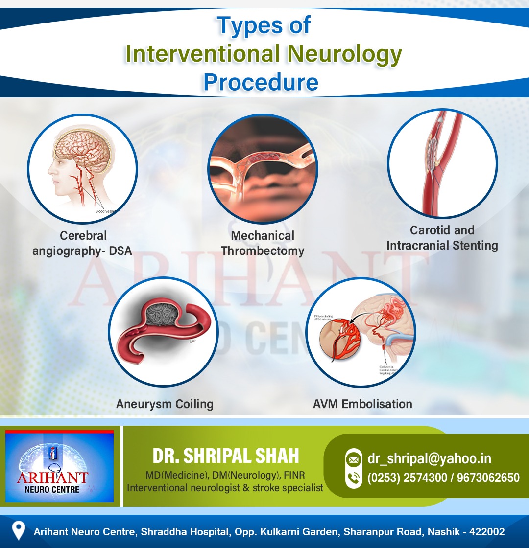 Know the different types of Interventional Neurology procedures.
To Know More
Visit: drshripalshah.com
Call on: (0253) 2574300 / 9673062650
#neurointerventional #interventionalNeurology #neurologist #doctor #hospitalinnashik #nashikdoctor #interventionalneurologist