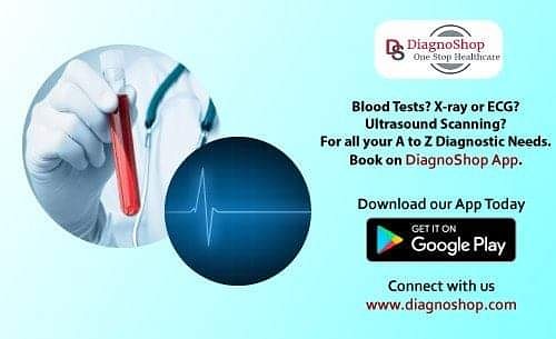 diagnoshop's tweet photo. Any Blood Tests, X-ray, ECG or ultrasound scanning book on diagnoshop!!!
Visit us @ https://t.co/4fsAcm21ef
Phone : +91-4023737715
8331013881
#diagnoshop #diagnosticcenters #bloodtest #ECG #ultrasound #scanning #book #appointmenton  #diagnoshopapp  #download #diagnoshopapptoday https://t.co/0PRVuDGPFP