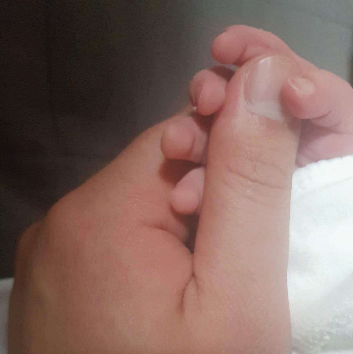 아가 태어낫냐고 물어보시는분이 간혹계셔서,,!
아가는 잘태어나서 잘자라는중입니다 😚😚❣

손발 쬐고매,, 너모 기여워요,,, 😢