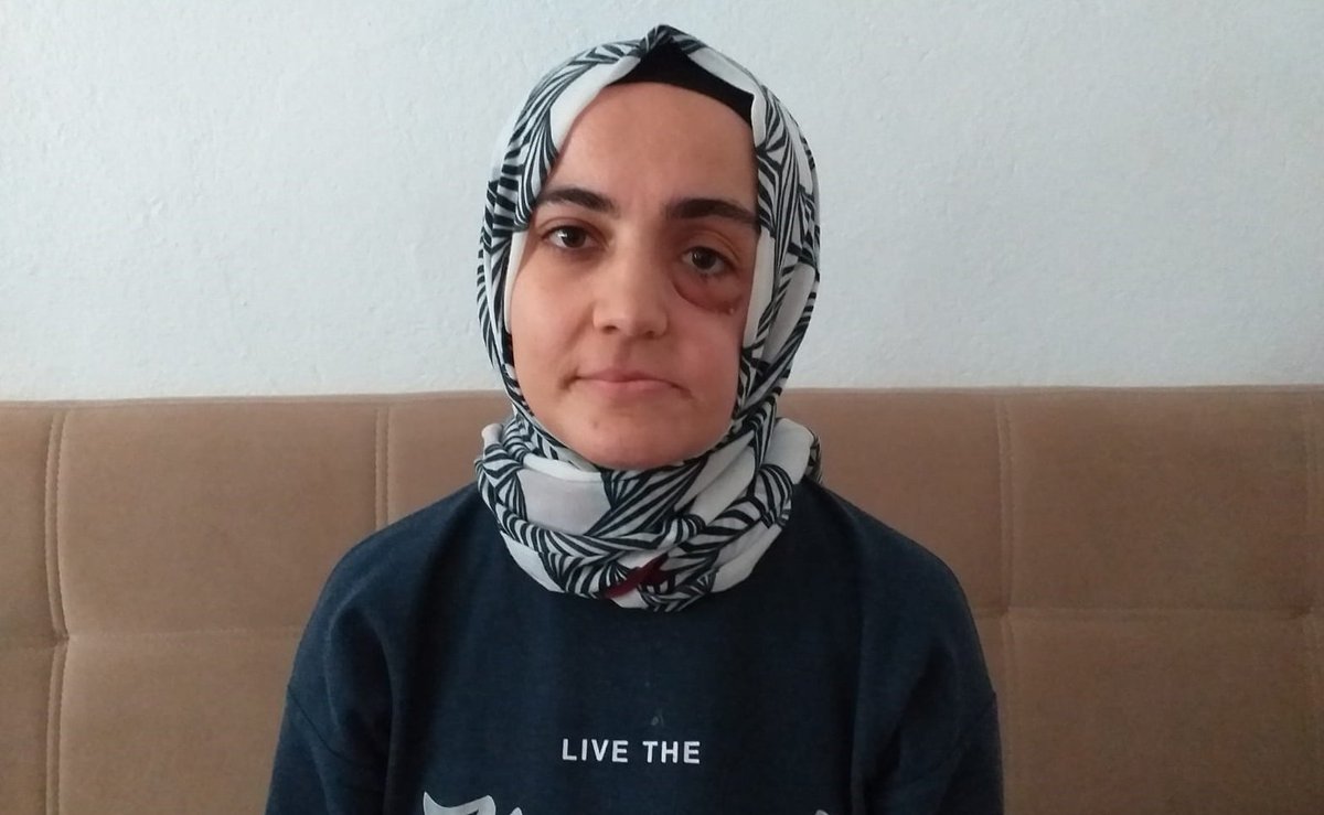 Bankada 300 TL para, dernek üyeliği, tanık ifadesi, Bylock ve kız yurdunda SSK kaydımın olması iddiasıyla beni hapse göndermek istiyorlar. Ben kimseyi öldürmedim. Kimseye zarar vermedim. <a href="/cigdemkc/">ÇİĞDEM KOÇ</a> <a href="/adalet_bakanlik/">T.C. Adalet Bakanlığı</a> <a href="/MSTanrikulu/">Sezgin Tanrıkulu</a> <a href="/Cemrebirand1/">Cemre Birand</a> <a href="/HurAyse/">Ayşe Hür</a> 

AyşeÖzdoğan İçinSesOl