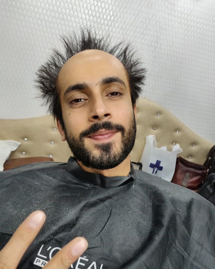 preetisheel's tweet photo. Bald and cutieful✨ #throwback to this amazing makeover for #UjdaChaman

@MarkTroyD @Da_MakeUpLab
@mesunnysingh
@AbhishekPathakk @maanvigagroo @TSeries #damakeuplab #sunnysingh #baldcapapplication #prosthetics #baldmakeup #baldmakeuplook #baldmen #prostheticmakeupartist https://t.co/UUsw6vqF1n