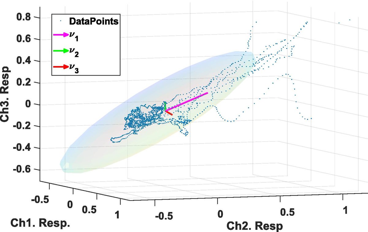 ClinicalNeuroph's tweet image. [EEG in coma] Khanmohammadi et al.: “Intrinsic brain dynamics distinguish different levels of consciousness in comatose patients.”

doi.org/10.1016/j.clin…
@WUSTL
#EEG #Comatose #ClinicalNeuroph