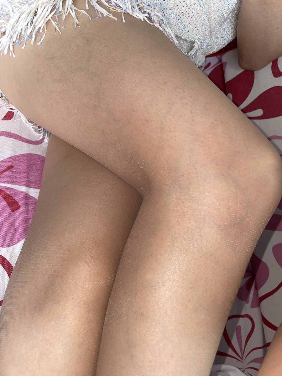 老婆的丝袜脚百玩不厌，抱着闻，抱着舔 https://t.co/hNi5Yh36bF