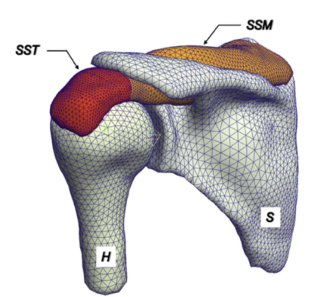 CyrusRezvanifar's tweet photo. If you are attending #SB3C2021 and are interested in hearing and chatting about rotator cuff FE modeling and supraspinatus tendon, please stop by poster “265B” tomorrow (Wednesday) from 2:30-4:00pm ET. Looking forward to seeing you all! https://t.co/dvhqi7MQBK