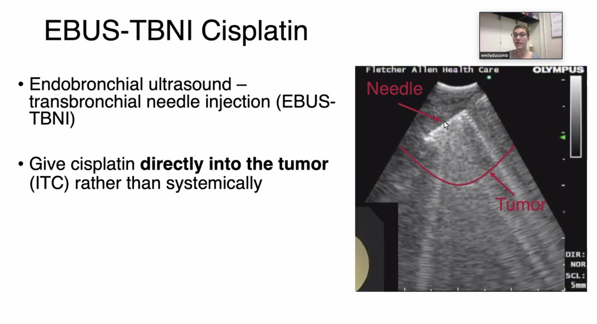 Great final VLC conference from Emily DuComb today. Presenting her EBUS-TBNI project.  Congrats Emily!