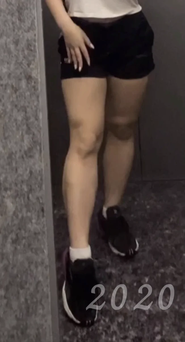 筋肉質の脚だと思っていたら…実は固くなった脂肪だった！