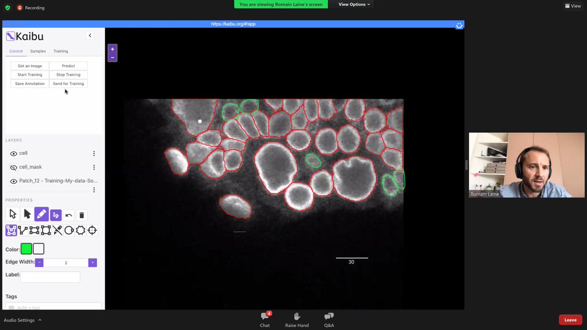 What a #NeubiasAcademy webinar! @guijacquemet and @LaineBioImaging demo-ing #ZeroCostDL4Mic. Including applications integrating #TrackMate and #CellPose. Just now: interactively building a training dataset using #Kaibu.🤩🤯 @NEUBIAS_COST