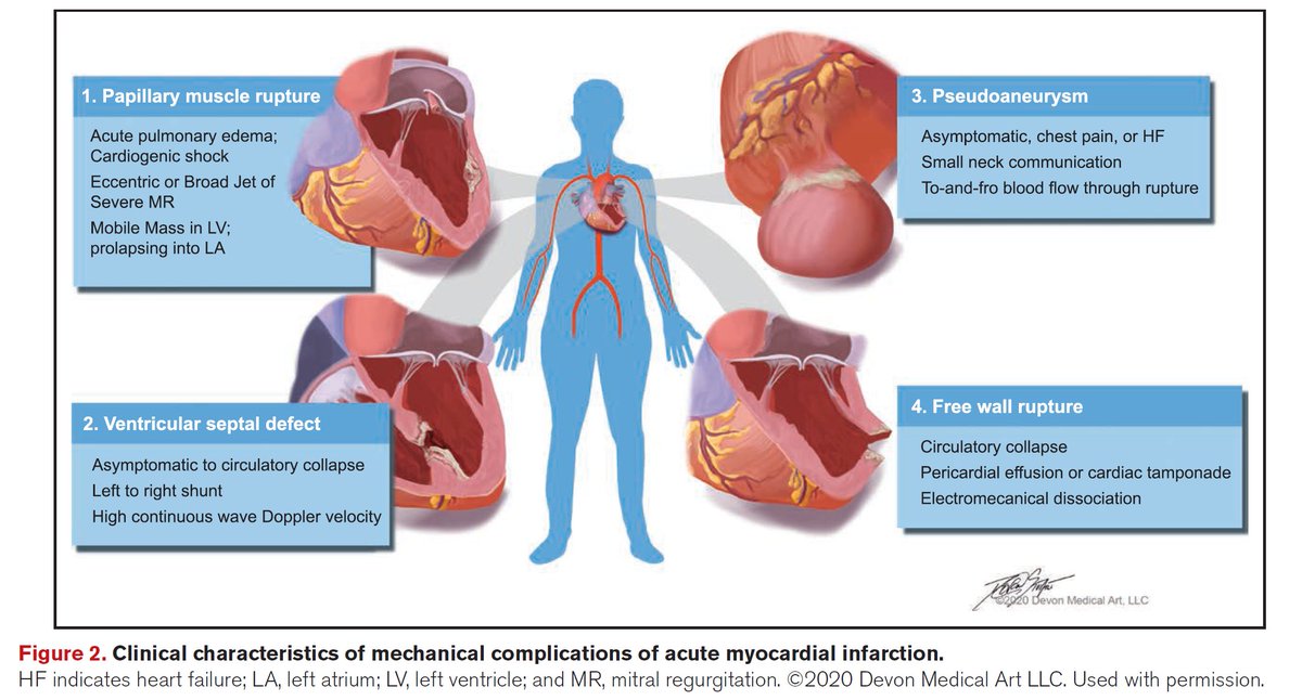 Sean van Diepen tweet media