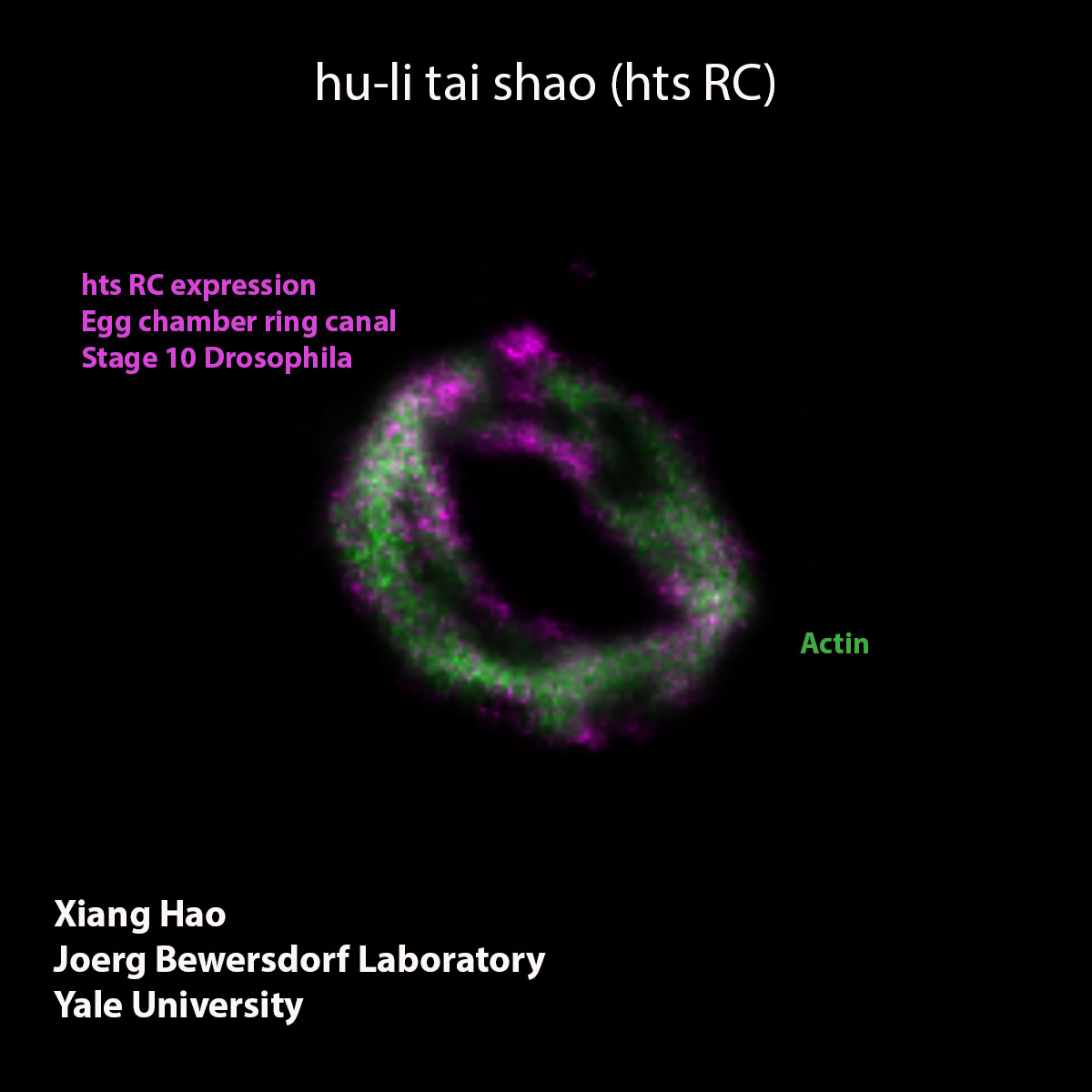 DSHB_antibodies's tweet photo. Egg chamber ring canals provide a perfect model to demonstrate sub-50-nm fluorescent structure resolution using nanoscopy methods to circumvent the optical diffraction limit (PMID: 34059828). Order hts RC (RRID: AB_528289 ) at $40/ml. https://t.co/h5EsfVOQz8 #Flybase #Nanoscopy https://t.co/g6xkgROdNY