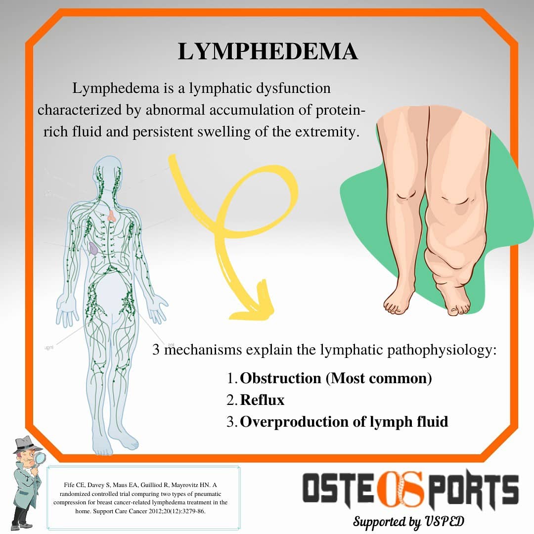 Osteosports (@osteosportscom) on Twitter photo 