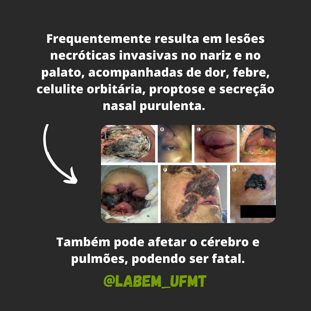 labem_ufmt's tweet photo. Mais uma curiosidade sobre o mundo microbiano 👉🦠
https://t.co/FgdmPihrIh https://t.co/M2S9q5h7lq