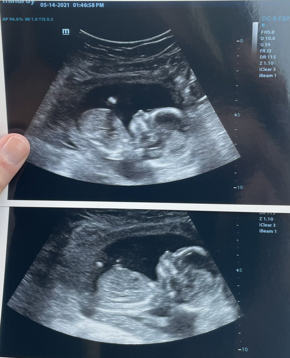 emelisesmart's tweet photo. Only some of my favorite pictures from the past couple of weeks💗 no love compares to the love I have for our little family https://t.co/fbHflcykXJ