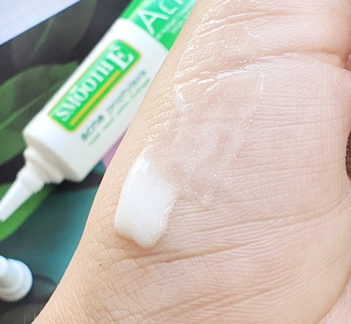 iffieben's tweet photo. แก..มีไอเทมมาป้ายยา เจลแต้มสิว Smooth E หลอดเขียว ใช้กับสิวไม่มีหัว นอนดึกสิวปูด เห็นความบวมแดงนั้นมั้ย หยิบเจลมาแต้มก่อนนอน ว่าไม่ได้นะคะ อักเสบลด สิวยุบเด้อ เพราะเค้ามีส่วนผสมที่ออกฤทธิ์ทันที แต่ไม่แสบนะ อันนี้ชอบ #สิวหายเหมือนได้เจอหมอ แล้วไม่ต้องกลัวนะ นางไม่มีไม่มีสเตียรอยด์ https://t.co/2GYBLKFvkG