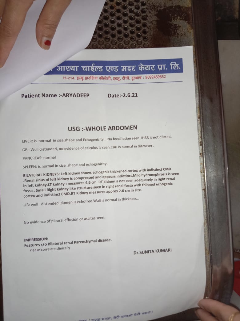 sohansingh05's tweet photo. मासूम सा दिखने वाला बच्चे को नहीं पता उसे क्या बीमारी है और गरीब पिता जिंदगी बचाने के लिए सबसे प्रार्थना कर रहा है कोई तो उसके बच्चे की जिंदगी बचा लीजिए।बच्चा का किडनी खराब हो गया है,राँची के आस्था हॉस्पिटल में भर्ती है।🙏
 8249747513 8936000121
@HemantSorenJMM
@KunalSarangi https://t.co/i9QHWujq6j