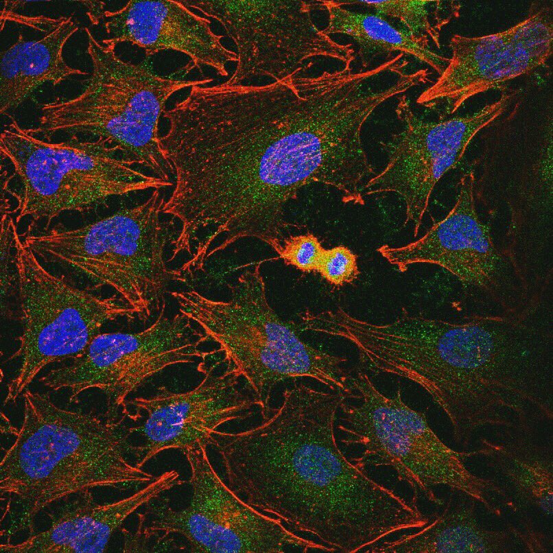 naregdegirmenci's tweet photo. Cells never cease to amaze me. #lovewhatyoudo #Microscopy #IFstaining https://t.co/dSeuKUf2aX