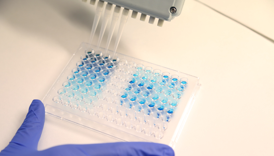 VHIR_'s tweet image. El grup de recerca en Nanoeines Diagnòstiques ha dotat al test ELISA d&apos;altes prestacions per a poder detectar la #malària de manera quantificable en una hora i amb una sensibilitat propera a la PCR. @CIBERBBN 
T&apos;expliquem aquests súper tests: bit.ly/3yVtdC1