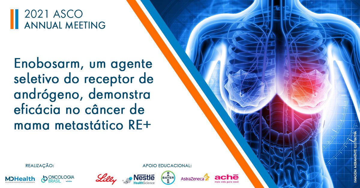 BrasilOncologia's tweet photo. Estudo apresentado durante o Congresso Mundial da #ASCO21 mostra que #enobosarm pode representar uma futura e promissora abordagem de tratamento hormonal para pacientes com #câncerdemama metastático RA+/RE+: https://t.co/qKsw5RArFm https://t.co/fZtlw7uYXL