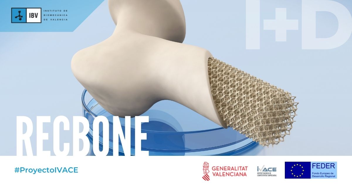 ibv_org's tweet photo. A través del #ProyectoIVACE➡️ #RECBONE, cuya financiación ha sido solicitada a @GVAivace cofinanciada por los #fondosFEDER, estamos trabajando en la generación de conocimiento nuevo en relación al ciclo de vida del #productosanitario destinado a la reconstrucción articular y ósea https://t.co/M1juO2nP7U