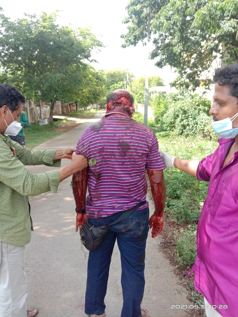 frustratedmed's tweet photo. Do indians deserve drs. They r striving from mrng to evng in ppe kits n u assault them. U cant even put mask . Prvt hospitals r taking money politicians r supporting it n in between drs r getting beaten
#StopViolenceAgainstDoctors 
#MedTwitter https://t.co/Gs9uaTl2OM